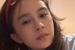 赵樱子自曝把脸部填充都融掉了，只剩假体鼻子无法复原