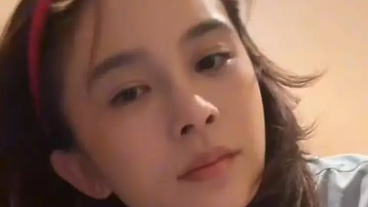 赵樱子自曝把脸部填充都融掉了，只剩假体鼻子无法复原