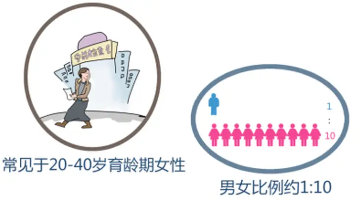 红斑狼疮女性备孕生子有明确标准 满足两大关键条件才可安全妊娠