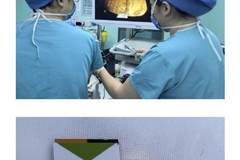 5岁女童不慎吞了50克金条