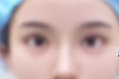 未成年人医美风险警示：正规机构劝退非必要整形 畸形审美侵蚀青少年健康成长