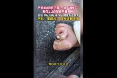 产检一路“绿灯”,宝宝出生后双脚却严重畸形,医院回应:按筛查标准不检查四肢,属于医学盲区,主张无责任